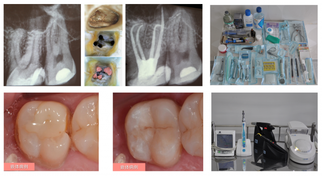 现代根管治疗+微创修复实战学习班——南宁
