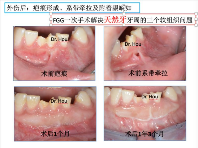 侯建霞 牙周病学高级班